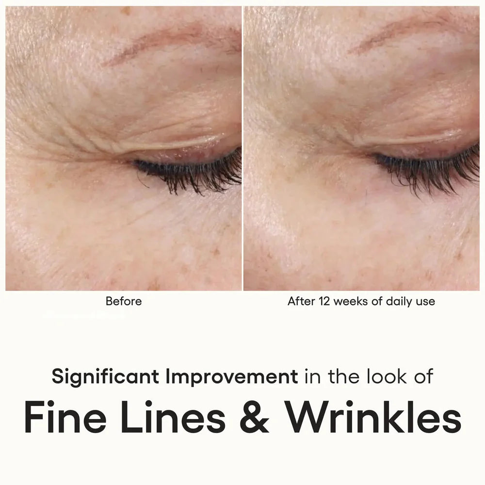 ( plated ) Skin Science INTENSE SERUM