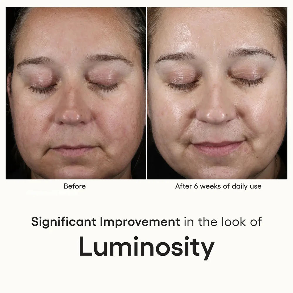 ( plated ) Skin Science INTENSE SERUM